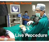 surgery live procedure
