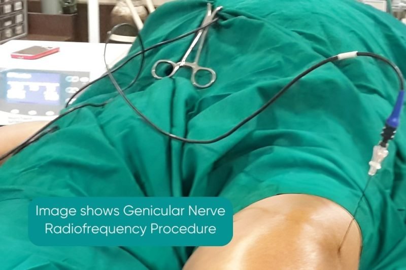 Genicular Nerve Radiofrequency Ablation